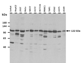 MUC1 Rabbit Polyclonal Antibody