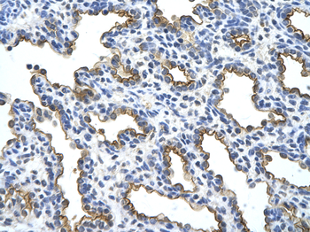 MUC1 Rabbit Polyclonal Antibody