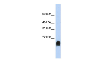 MUC1 Rabbit Polyclonal Antibody