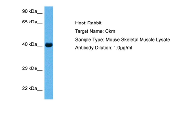 CKM Rabbit Polyclonal Antibody