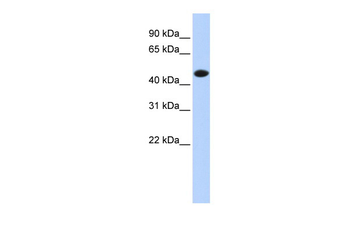 CKM Rabbit Polyclonal Antibody