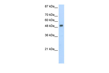 DES Rabbit Polyclonal Antibody