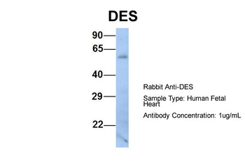 DES Rabbit Polyclonal Antibody