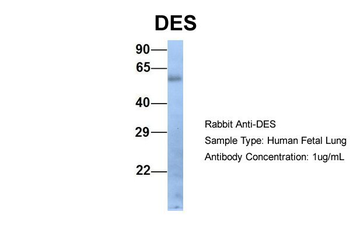 DES Rabbit Polyclonal Antibody