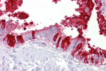 SCGB1A1 Rabbit Polyclonal Antibody