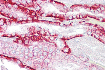 CDH16 Rabbit Polyclonal Antibody