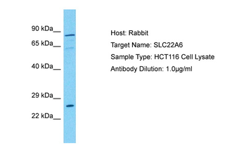 SLC22A6 Rabbit Polyclonal Antibody