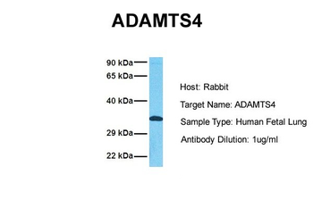 ADAMTS4 Rabbit Polyclonal Antibody