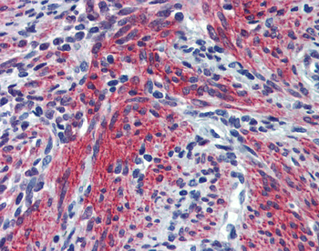 POSTN Rabbit Polyclonal Antibody