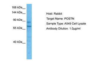 POSTN Rabbit Polyclonal Antibody