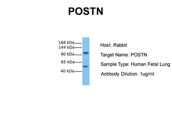POSTN Rabbit Polyclonal Antibody