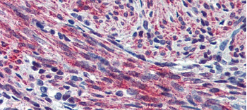 POSTN Rabbit Polyclonal Antibody