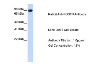 POSTN Rabbit Polyclonal Antibody