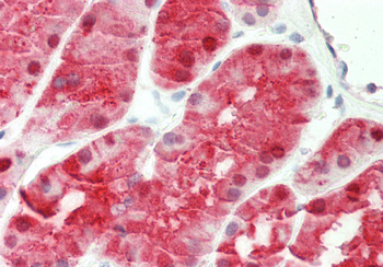 KHK Rabbit Polyclonal Antibody