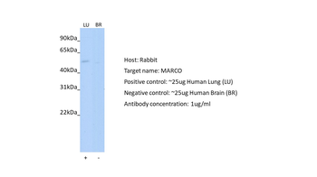 MARCO Rabbit Polyclonal Antibody