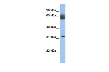 C11orf54 Rabbit Polyclonal Antibody