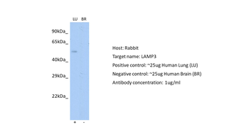 LAMP3 Rabbit Polyclonal Antibody