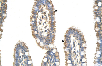 ANAPC7 Rabbit Polyclonal Antibody