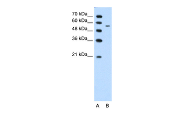 CHST7 Rabbit Polyclonal Antibody