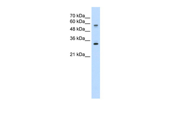 SLC22A1 Rabbit Polyclonal Antibody