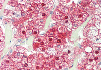 ALAD Rabbit Polyclonal Antibody