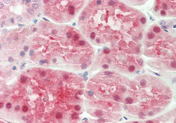 ALAD Rabbit Polyclonal Antibody