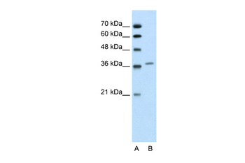 ALAD Rabbit Polyclonal Antibody