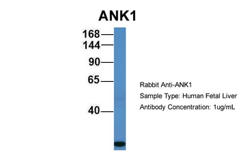 ANK1 Rabbit Polyclonal Antibody