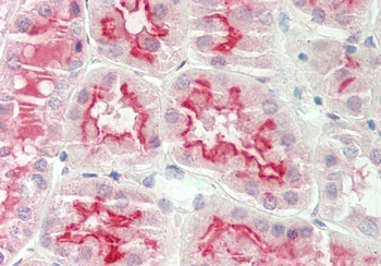 ARSE Rabbit Polyclonal Antibody