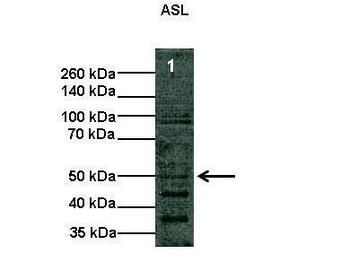 ASL Rabbit Polyclonal Antibody