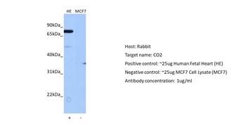 C2 Rabbit Polyclonal Antibody
