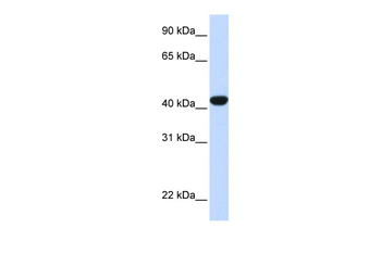 FAH Rabbit Polyclonal Antibody