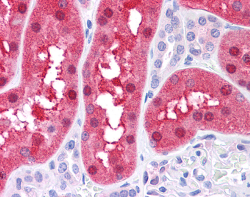 FAH Rabbit Polyclonal Antibody
