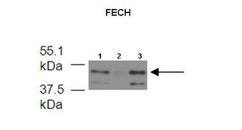 FECH Rabbit Polyclonal Antibody