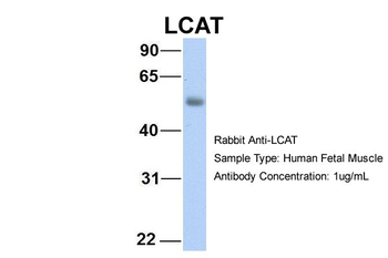 LCAT Rabbit Polyclonal Antibody