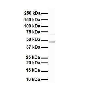 KRT17 Rabbit Polyclonal Antibody