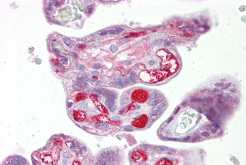 SLC26A4 Rabbit Polyclonal Antibody