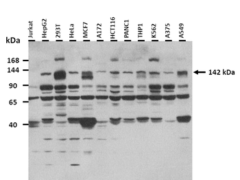 ABCB4 Rabbit Polyclonal Antibody