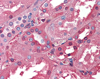 ALB Rabbit Polyclonal Antibody