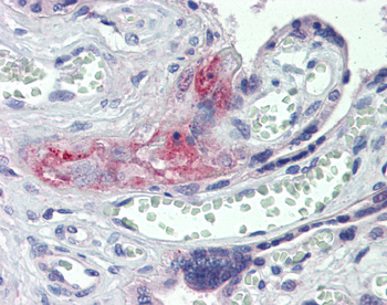 F2 Rabbit Polyclonal Antibody