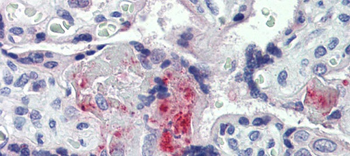 F2 Rabbit Polyclonal Antibody