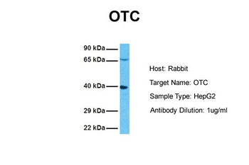 OTC Rabbit Polyclonal Antibody