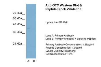 OTC Rabbit Polyclonal Antibody
