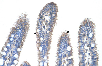 OTC Rabbit Polyclonal Antibody