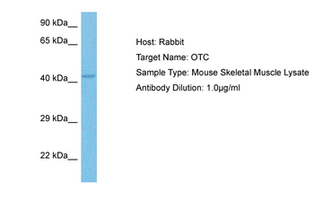 Otc Rabbit Polyclonal Antibody