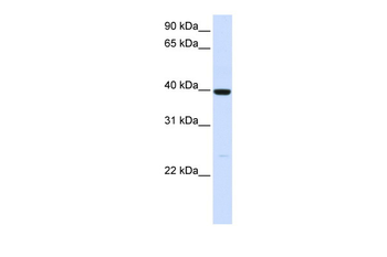 ADH1A Rabbit Polyclonal Antibody