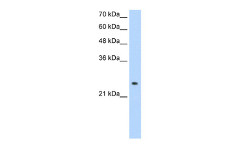 ADH6 Rabbit Polyclonal Antibody