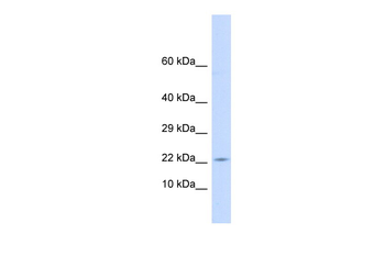 CRH Rabbit Polyclonal Antibody