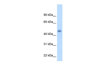 CYP3A7 Rabbit Polyclonal Antibody