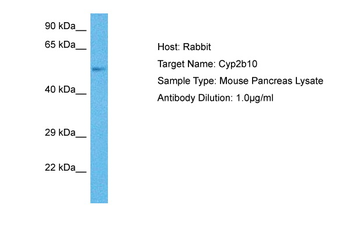 CYP2B6 Rabbit Polyclonal Antibody